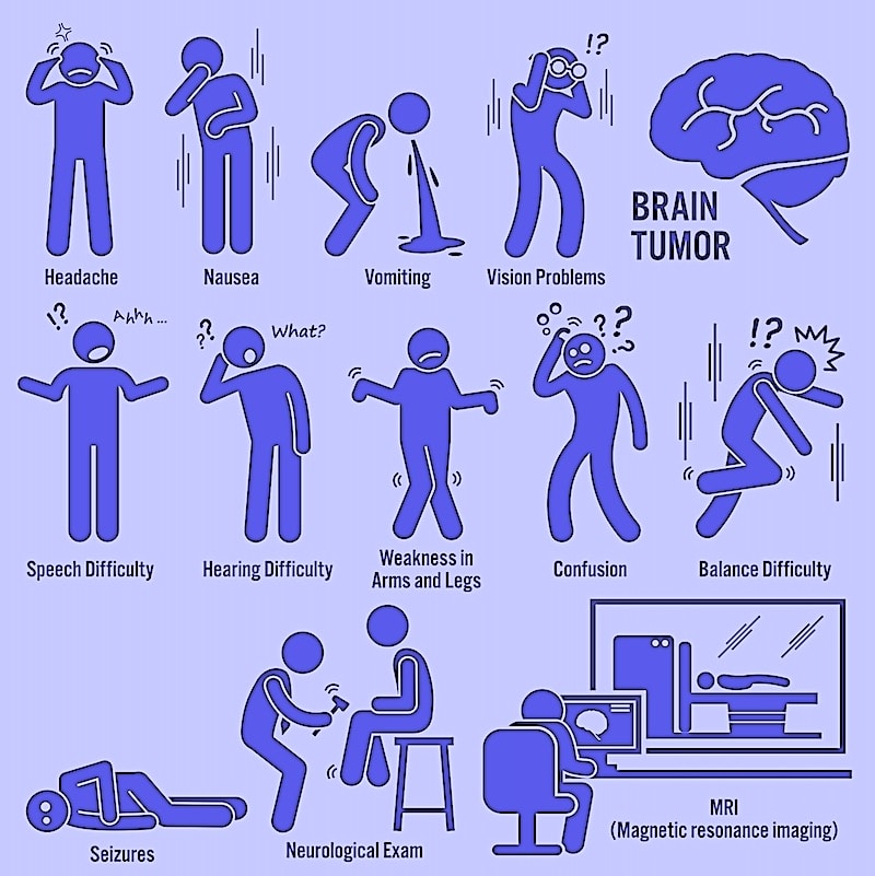 brain tumor symptoms