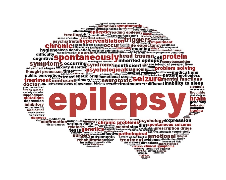 Brain Surgery for Epilepsy - Brain-Surgery.com